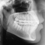 Radiologia Odontológica em Boa Vista